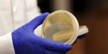 Influenza, funziona nei topi un vaccino universale
