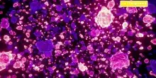 Tumori ginecologici rari, i tassi di guarigione sono elevati