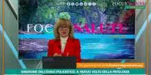 Focus Salute - Sindrome dell'ovaio policistico, il nuovo volto della patologia