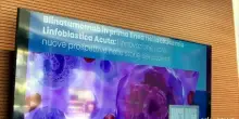 Leucemia, l'immunoterapia in prima linea cambia le prospettive