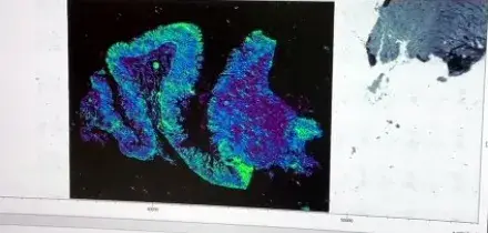 Un microscopio a infrarossi per riconoscere le cellule malate