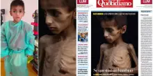 Il piccolo Osama è malato, ma il Fatto sbatte la foto in prima pagina, accusa Israele e omette la fibrosi cistica: così la sofferenza diventa regia