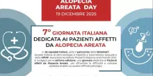 Alopecia Areata Day, il 19 dicembre consulenze gratuite alla clinica dermatologica Federico II di Napoli