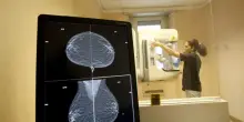 Tumori al pancreas, cancellato lo studio per trovare la cura. La causa nel &ldquo;grave conflitto di interessi&rdquo;