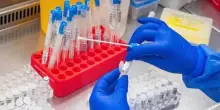 Laboratori biologici finanziati dagli Usa in Ucraina: cosa sappiamo dopo la declassificazione