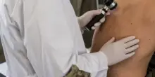 Stipendiato ma inutilizzato, la beffa del dermatologo militare: uno spreco a carico dello Stato?