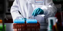 Convince il farmaco antimelanoma di Moderna: il titolo vola in Borsa