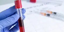Come sapere il proprio gruppo sanguigno (anche senza analisi)