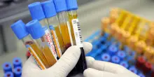 Primo caso di influenza aviaria H5 nell'Australia continentale