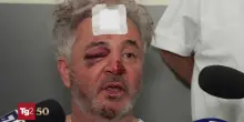 I feriti a Modena, la testimonianza: "Mi ritengo fortunato. C'&egrave; stata empatia di tutti"