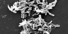 Bimbo di 18 mesi morto in ospedale a Catanzaro, cos'&egrave; il "Clostridium difficile" e come si trasmette