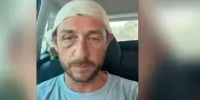 Olbia: picchiato perch&eacute; gay da 30 persone in spiaggia, indaga la procura