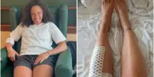 Federica Brignone dimessa dopo l'operazione a Milano: "Sto bene, tolte placca e viti"