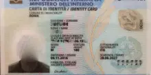 Carte d'identit&agrave; con microchip asportato chirurgicamente: ad Acerra il terzo caso in pochi giorni