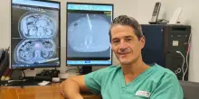 Tumore del pancreas non operabile, al Gemelli primo intervento al mondo con la &ldquo;colla&rdquo; radioattiva