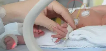 Miracolo di Natale, neonata di 600 grammi operata al cuore! Come sta