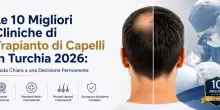 Le dieci migliori cliniche di trapianto di capelli in Turchia 2026
