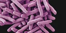 Focolaio di tubercolosi all&rsquo;Istituto di Medicina Legale di Milano: almeno 8 contagi tra i medici