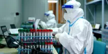 &ldquo;Il mondo &egrave; impreparato a una nuova pandemia&rdquo;: l&rsquo;allarme della rivista &ldquo;The Lancet&rdquo;