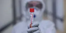 Trump vuole limitare la ricerca sui virus