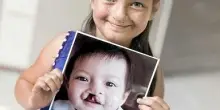 ”Impresa Sorriso”, Naos supporta l’impegno di Operation Smile