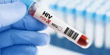 Dopo la pandemia crescono le diagnosi di Hiv