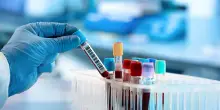 Sardegna: via libera al Piano regionale sangue 2025-2028