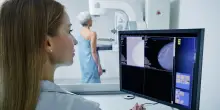 In Italia 52mila pazienti vivono con un tumore al seno metastico: “Ora cure per tutte”