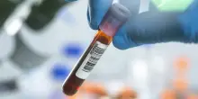 Hiv, via libera dell’Ema alla profilassi che si fa due volte l’anno