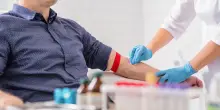 Epatite C, Puglia prima regione a proporre il test a tutti e a ogni analisi del sangue