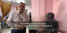 'A Khan Younis gli ospedali sono al collasso', racconta un medico al Nasser Hospital