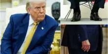 Insufficienza venosa cronica, cos'è la malattia diagnosticata a Trump