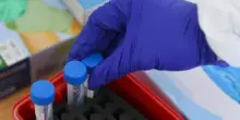 Covid, allarme per variante LP.8.1. Ema chiede aggiornamento vaccini