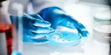 Candida auris, il fungo farmacoresistente che preoccupa l’Europa