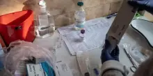 Tumori, test rivela chi non risponderà alla chemioterapia. Lo studio