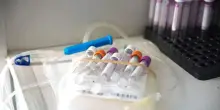 Giornata del donatore di sangue, AVIS: 'Record di raccolta di plasma'