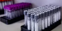 Giornata mondiale dei donatori di sangue, i dati e le iniziative
