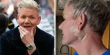 Gordon Ramsay operato per un tumore alla pelle