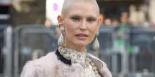 Bianca Balti: 'Credevo di morire, oggi festeggio l'essere viva'