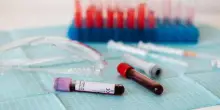 Malattie cardiovascolari: il nuovo esame del sangue che ne prevede il rischio