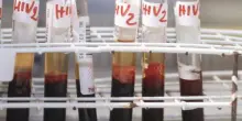 Salute, da Hiv a infezioni sessuali lotta a sommerso, al via settimana europea test