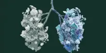 Le fibrosi polmonari, l'importante sfida per la sanità pubblica. Cosa è e a che punto è la ricerca