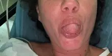 "Il giorno più brutto della mia vita". Il racconto di Eleonora Boi dopo l'attacco dello squalo