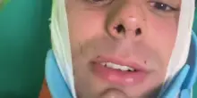 Alessandro, aggredito a Milano per un orologio: "Preso a martellate in testa. Ho rischiato di morire"