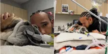 Il dramma di Lewis Hamilton, il suo Roscoe è in coma