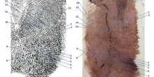Garlasco, niente svolta dalle impronte: "Impossibile estrarre il Dna"