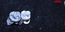Etiopia, trovati 10 denti di Australopithecus risalenti a due milioni di anni fa