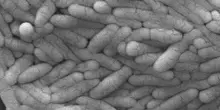 Salmonella in Spagna, 100 intossicati in hotel a Murcia