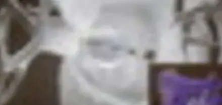 Un "palloncino" per il trattamento della fibrillazione atriale