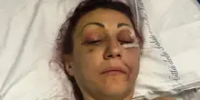 Lucia Regna massacrata dall'ex? Le toghe: "No al carcere. Lei ha sfasciato il matrimonio"